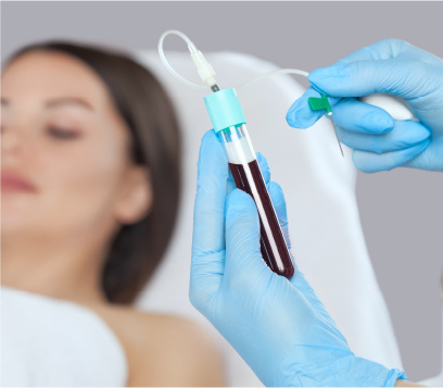 PRP